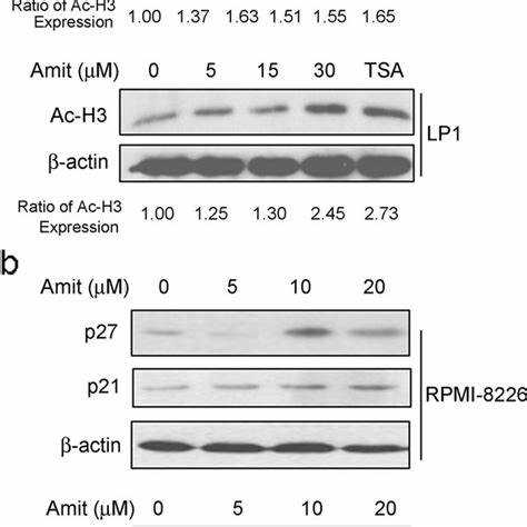 Amitriptyline and myeloma