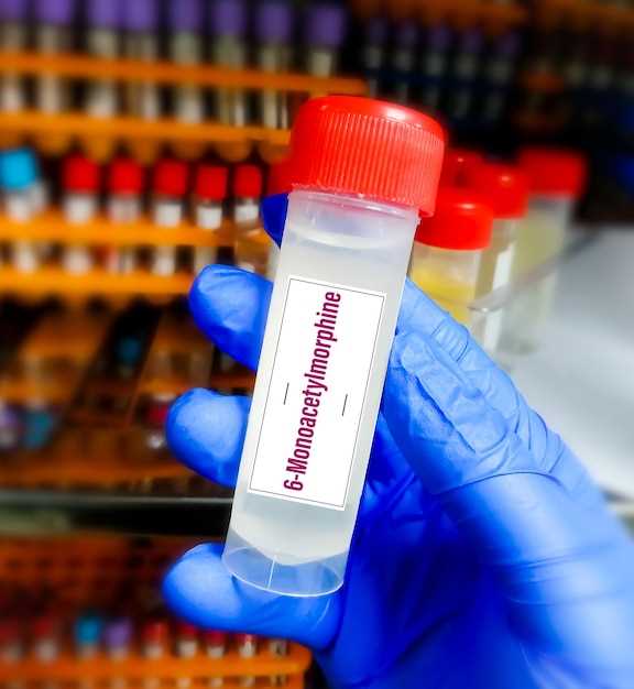 Azithromycin heumann 250