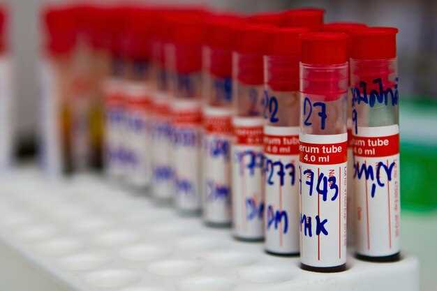Azithromycin iupac name