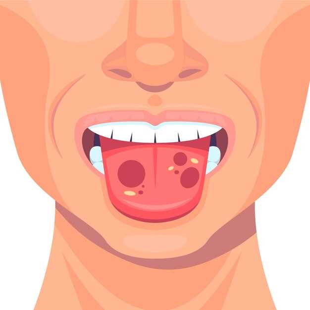 Azithromycin mouth ulcer