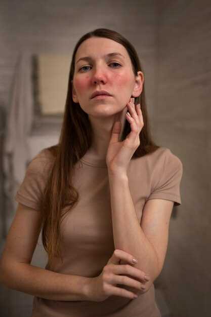 Clonidine treatment for rosacea