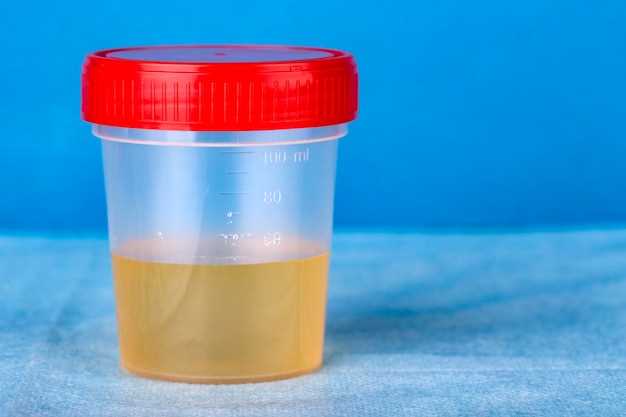 Clonidine urine metanephrines