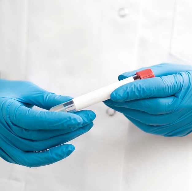 Do drug tests test for clonidine