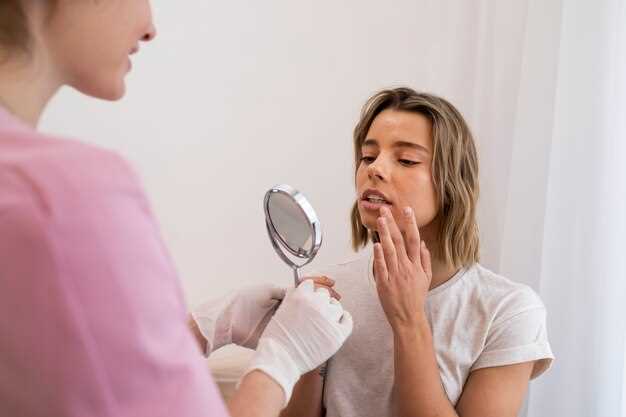 Benefits of Doxycycline for treating rosacea: