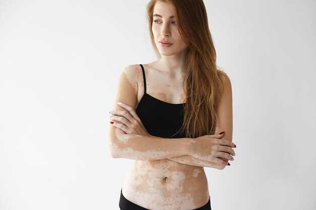 Doxycycline and skin rashes