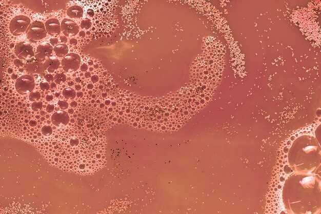 Doxycycline for clogged pores