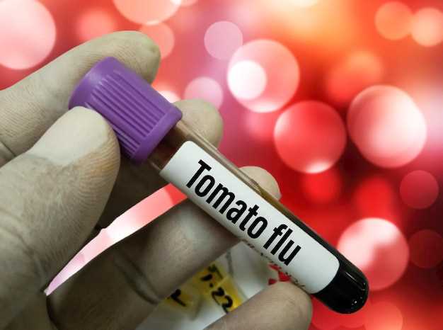 Doxycycline photosensitivity how long does it last