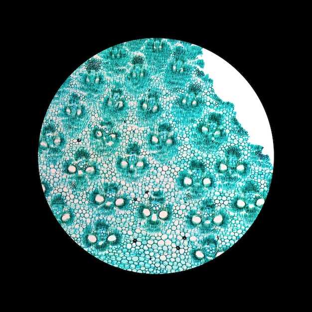 Doxycycline plus bactrim