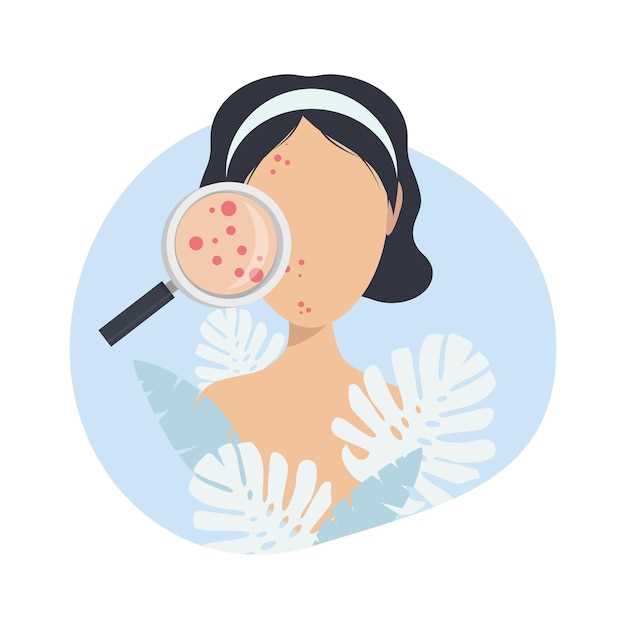 Doxycycline rosacea 100 twice daily day