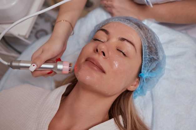 Doxycycline treatment