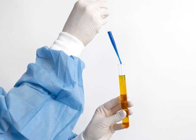 Duloxetine urine test