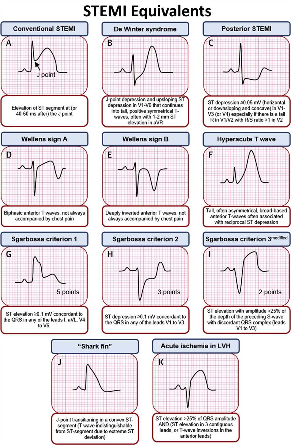Ecg changes amitriptyline