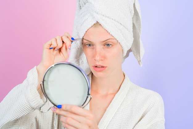 How long can you be on doxycycline for acne