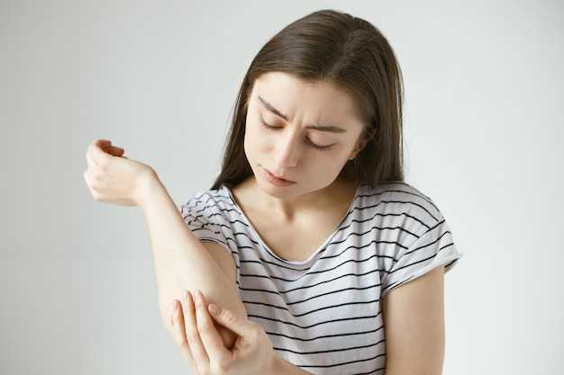 Is doxycycline good for eczema