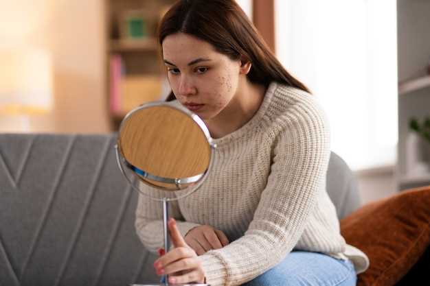 Understanding Rosacea